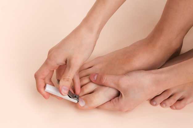 Основные причины возникновения онихолизиса на ногтях